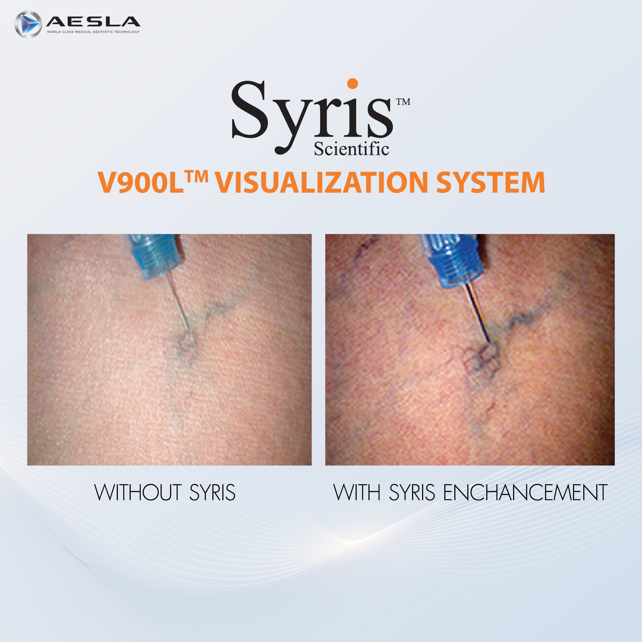 Syris V900L Visualization System