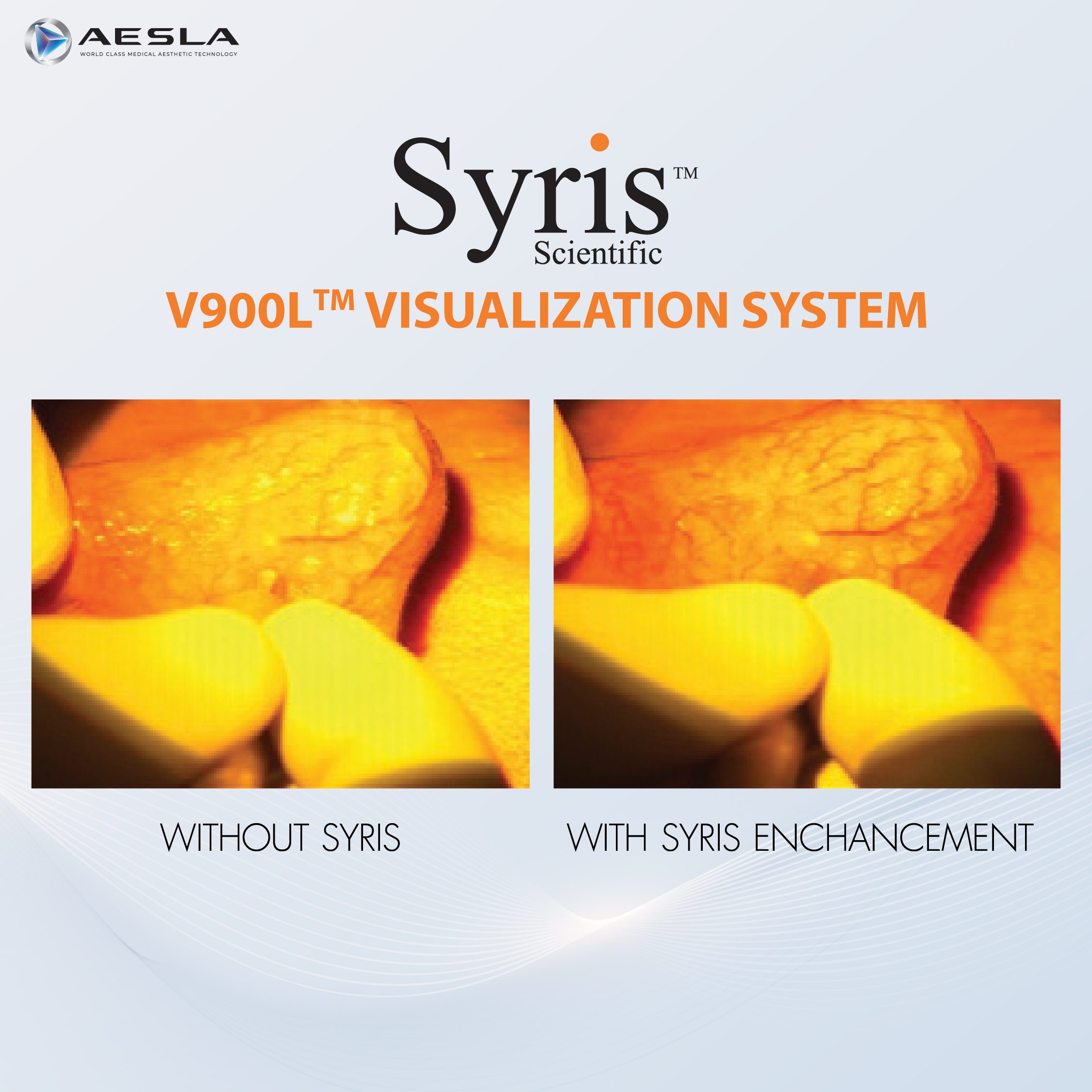 Syris V900L Visualization System