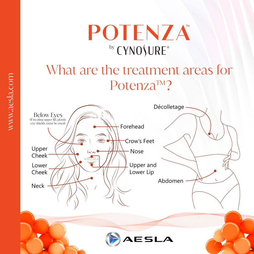 ตำแหน่งบนร่างกายที่เครื่อง Potenza สามารถรักษาได้