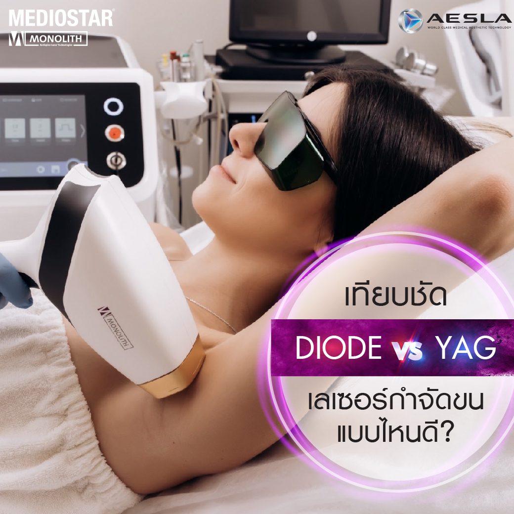 ไขข้อข้องใจ เลเซอร์กำจัดขน Diode กับ Yag แบบไหนดีกว่ากัน