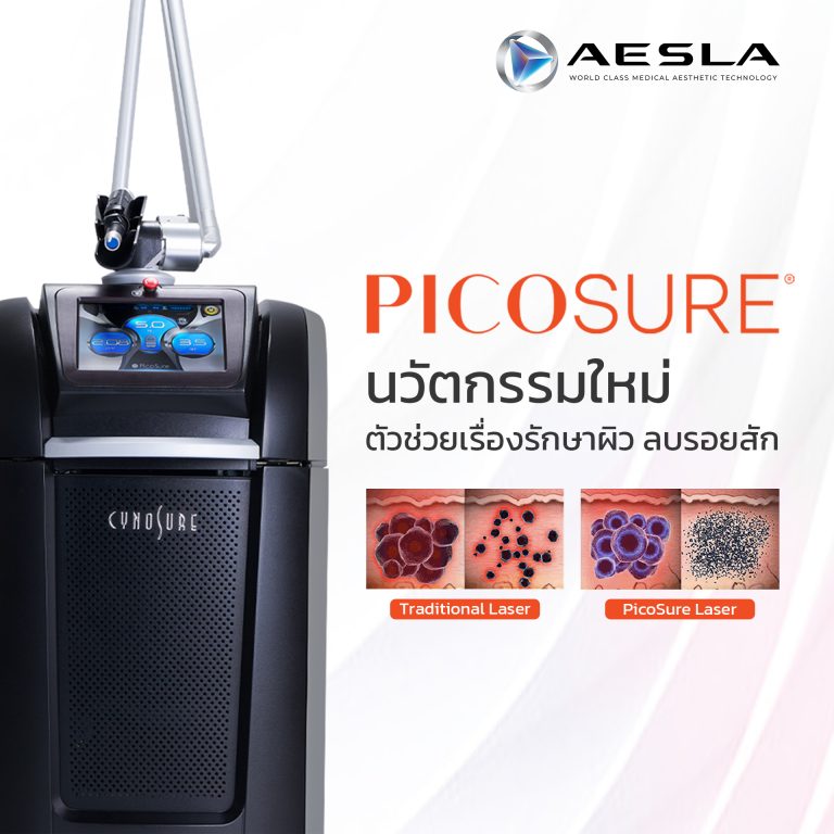 Picosure นวัตกรรมใหม่ตัวช่วยเรื่องรักษาผิว ลบรอยสัก