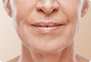 Skin Fine Lines & Wrinkles